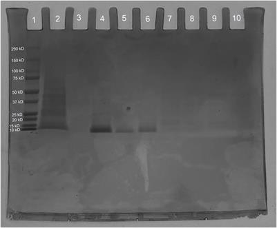 Accessible Type 2 diabetes medication through stable expression of Exendin-4 in Saccharomyces cerevisiae